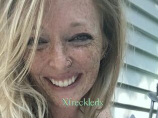 Xfreckledx